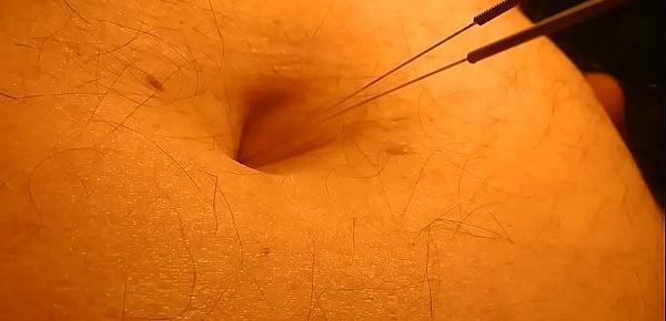 Belly Play piercing with acupuncture needles